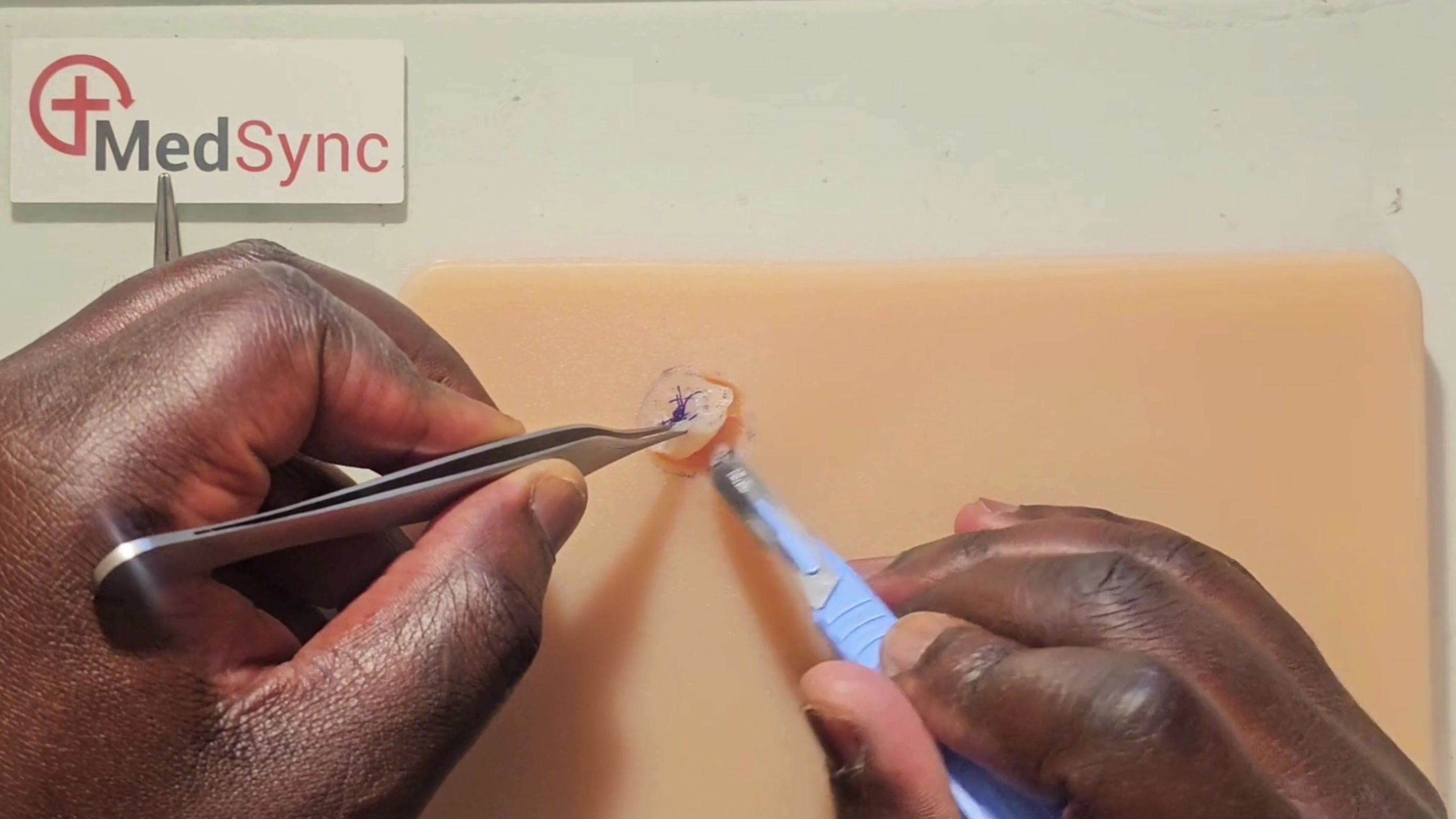 Biopsy of a lesion